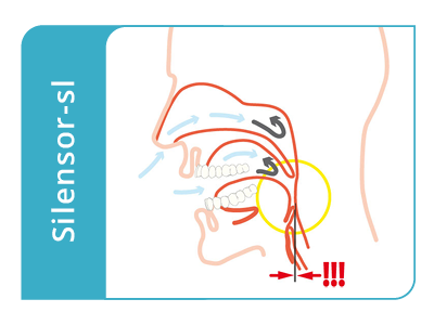 Silensor sl von InteraDent